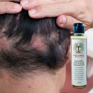 Hair and scalp treatment oil